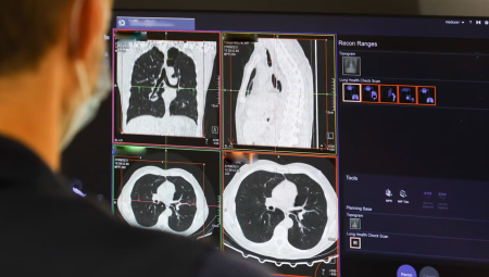 بسبب نقص الأطباء NHS تنفق 241 مليون جنيه على شركات خاصة لتحليل الأشعة